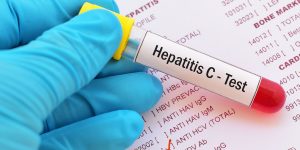 Inggris Bersiap Jadi Negara Pertama Bebas Penularan Hepatitis C